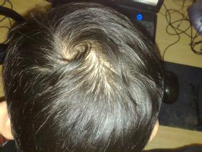 <a href='http://www.szfukang020.com/' target='_blank' title='深圳肤康专科'><span style='color: #0000ff'><strong>深圳肤康专科</strong></span></a>